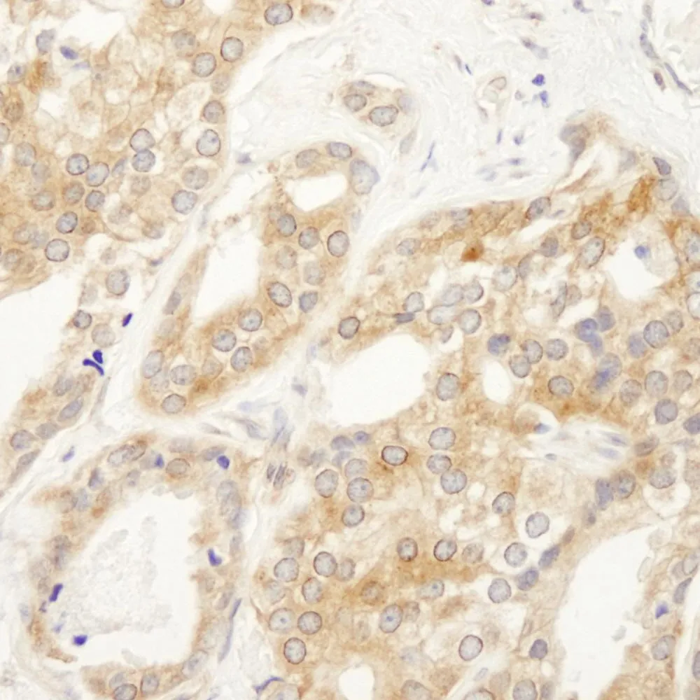Rabbit anti-DDX6 IHC Antibody, Affinity Purified