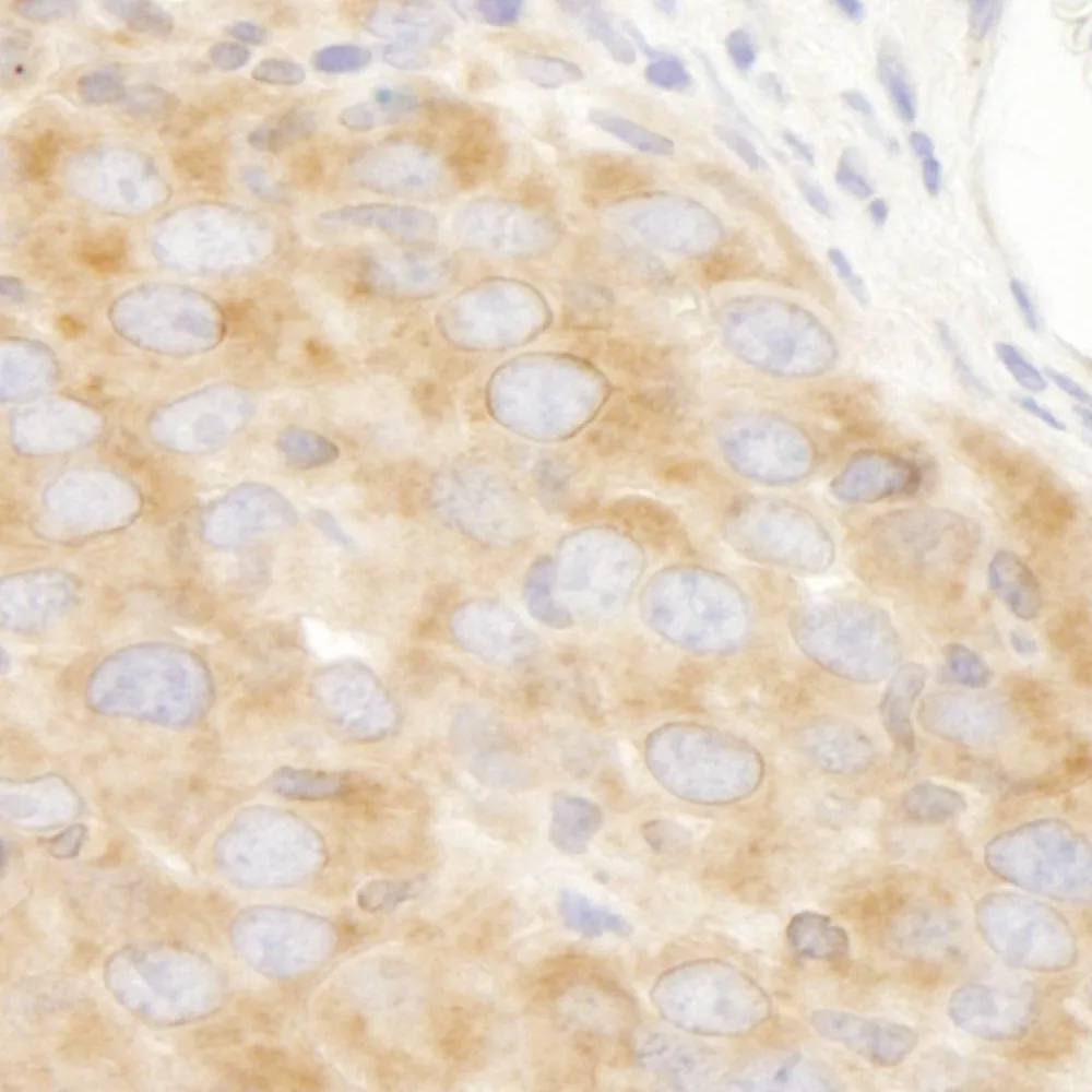 Rabbit anti-DDX3 IHC Antibody, Affinity Purified