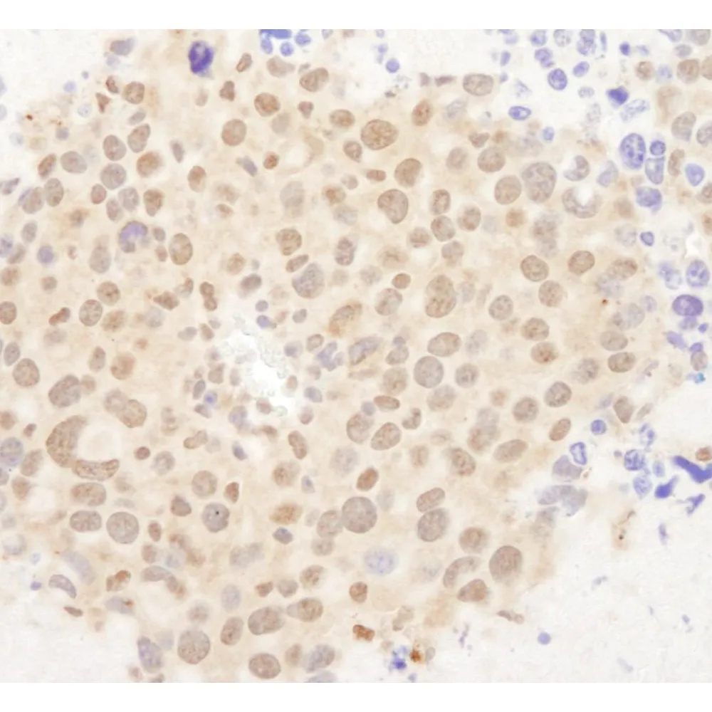 Rabbit anti-FOXO3a IHC Antibody, Affinity Purified