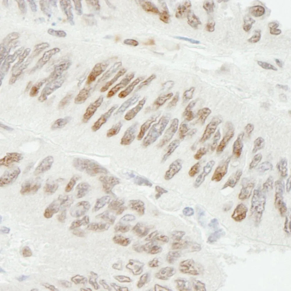 Rabbit anti-ZBTB7/FBI-1 IHC Antibody, Affinity Purified