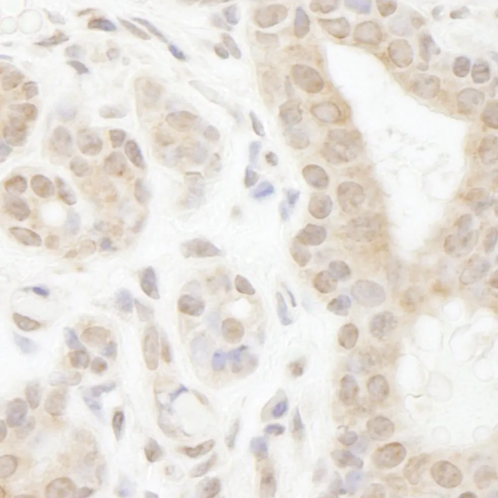 Rabbit anti-DDX20 IHC Antibody, Affinity Purified