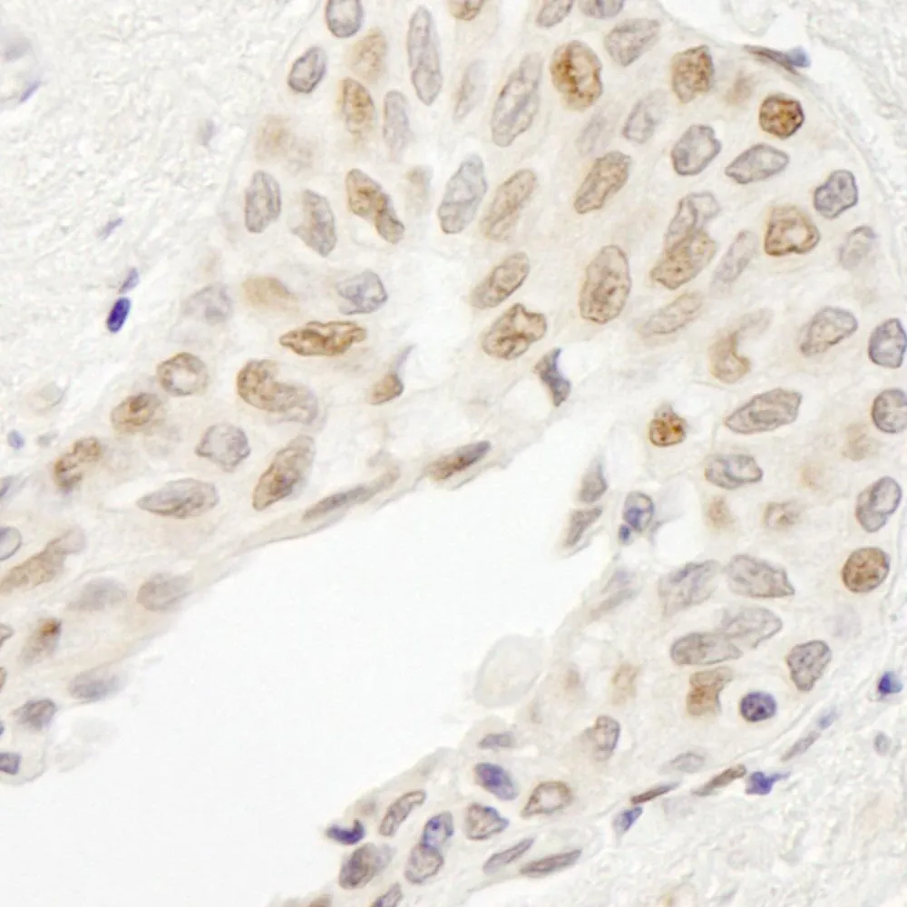 Rabbit anti-ATRIP IHC Antibody, Affinity Purified