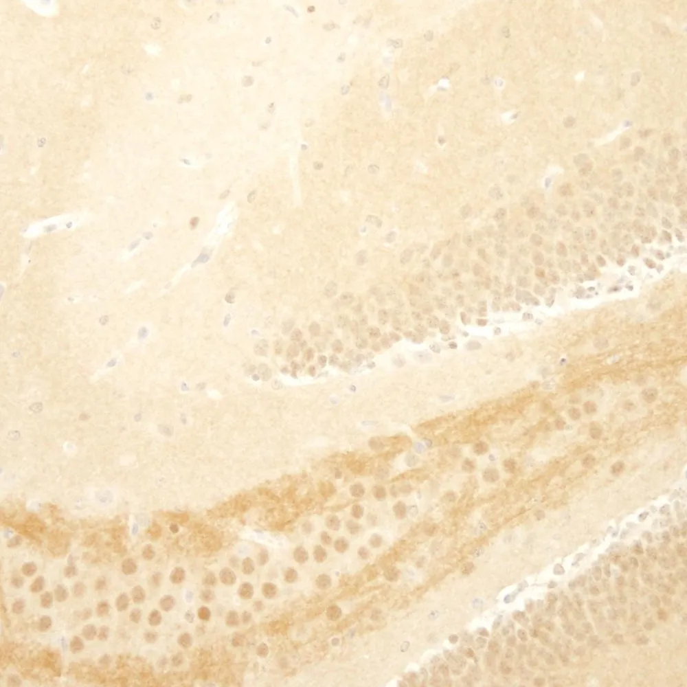 Rabbit anti-TORC1 IHC Antibody, Affinity Purified