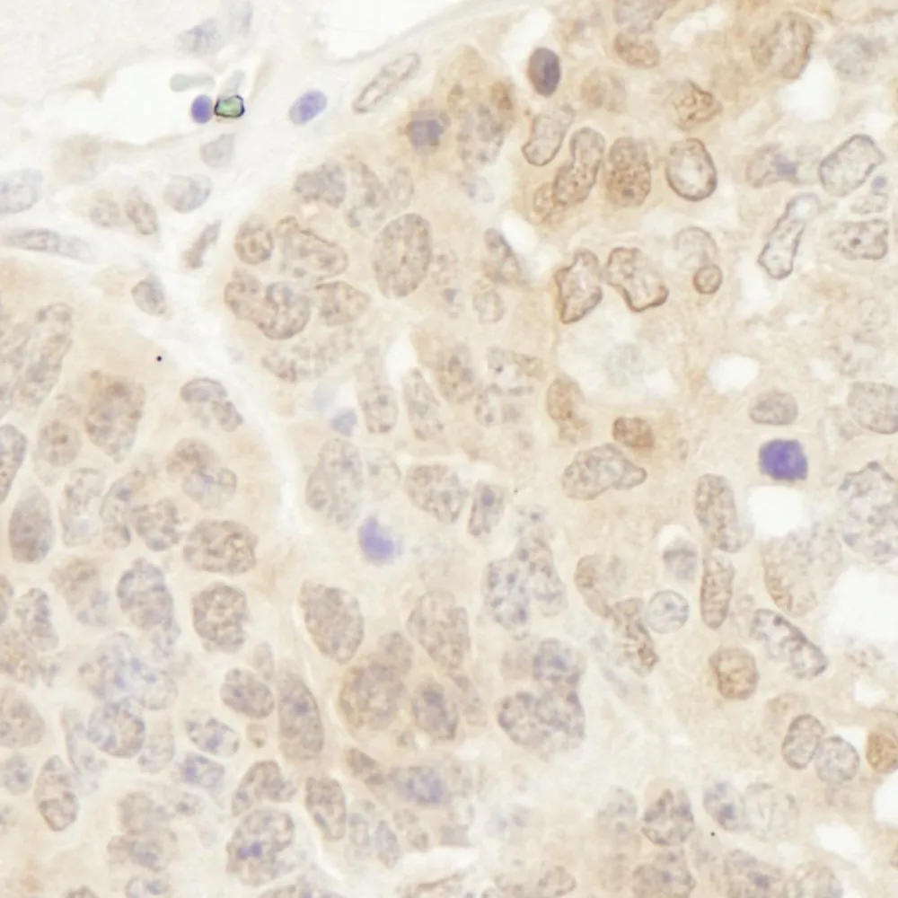 Rabbit anti-DJ-1 IHC Antibody, Affinity Purified