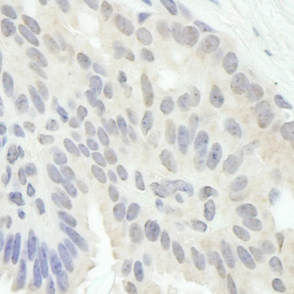 Rabbit anti-E2F1 IHC Antibody, Affinity Purified