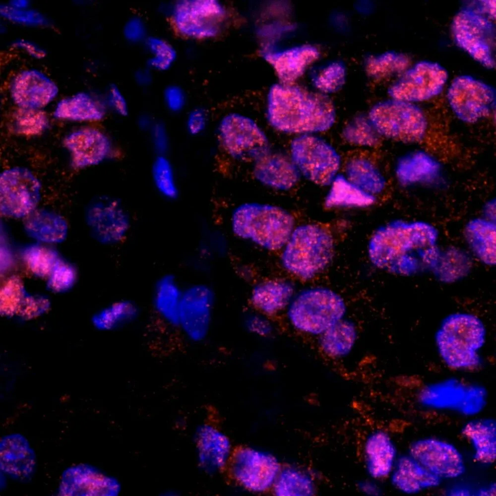 Rabbit anti-RAP80 IHC Antibody, Affinity Purified