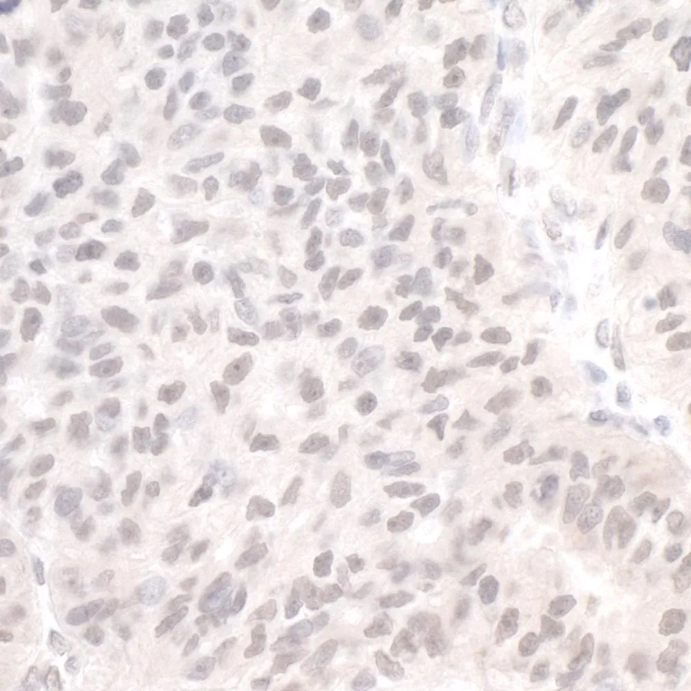 Rabbit anti-PIMT IHC Antibody, Affinity Purified