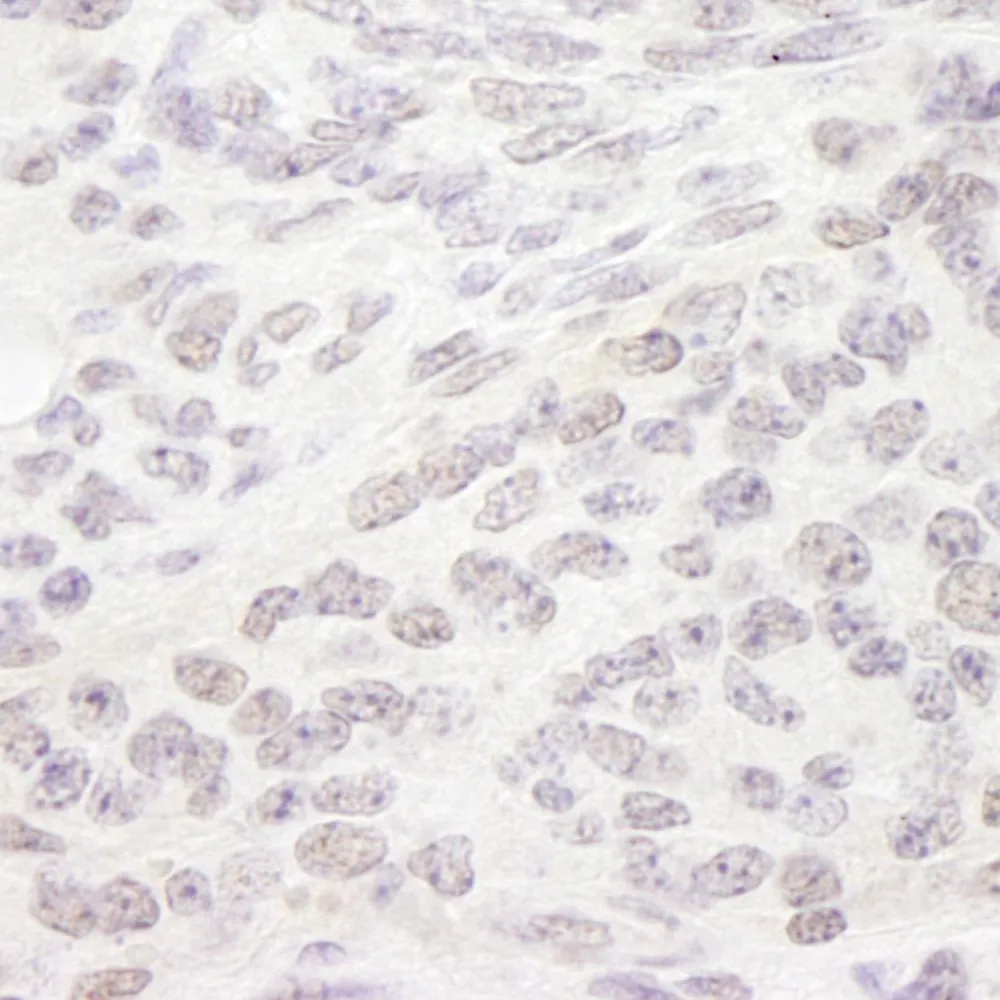 Rabbit anti-PPP4R3 Alpha IHC Antibody, Affinity Purified