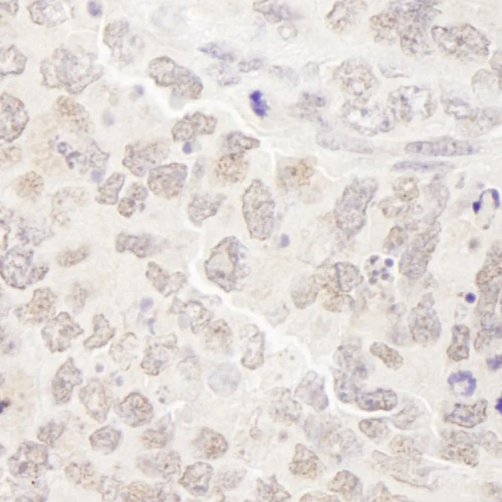 Rabbit anti-SKIV2L2 IHC Antibody, Affinity Purified