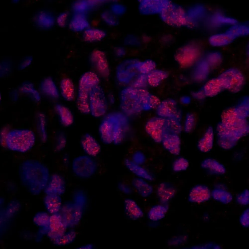 Rabbit anti-PPP4R3 Beta IHC Antibody, Affinity Purified