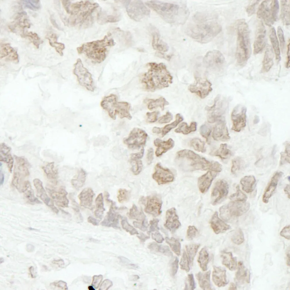 Rabbit anti-PAF49 IHC Antibody, Affinity Purified