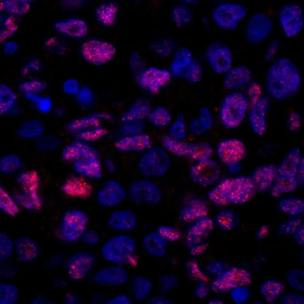 Rabbit anti-NCOA5/CIA IHC Antibody, affinity purified