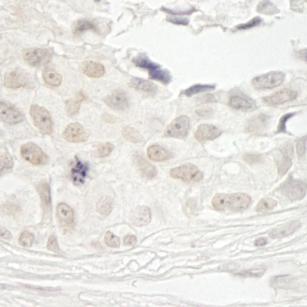 Rabbit anti-PPP1CB IHC Antibody, Affinity Purified