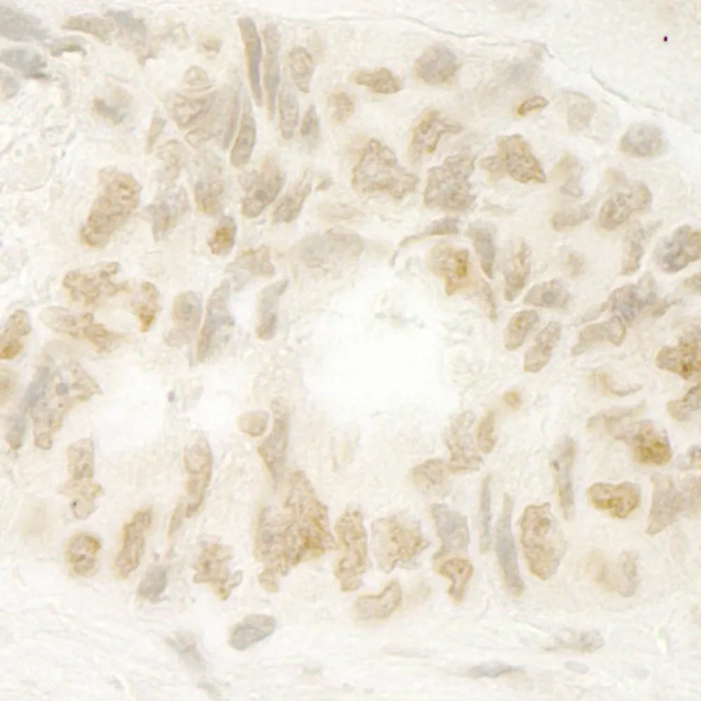 Rabbit anti-MKRN1 IHC Antibody, Affinity Purified