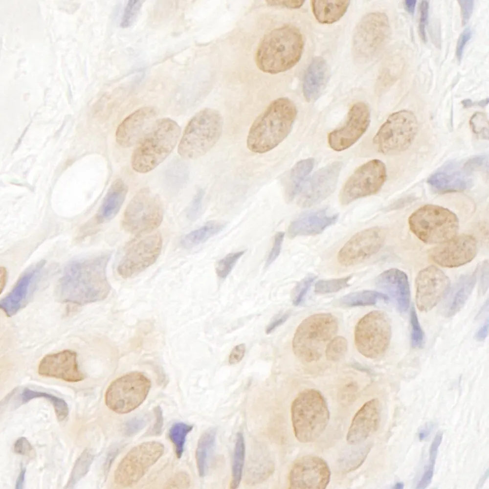 Rabbit anti-DOT1L IHC Antibody, Affinity Purified