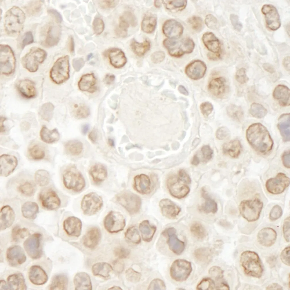 Rabbit anti-DTL/CDT2 IHC Antibody, Affinity Purified