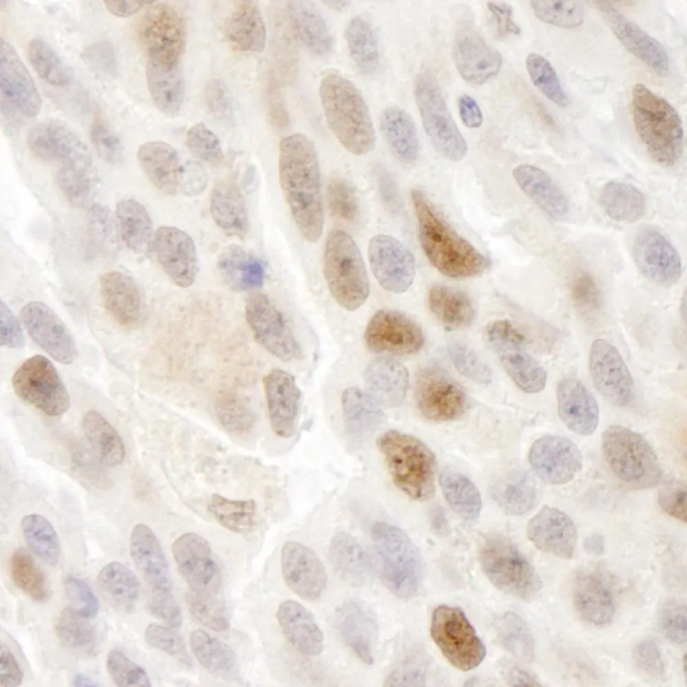 Rabbit anti-KIFC1 IHC Antibody, Affinity Purified