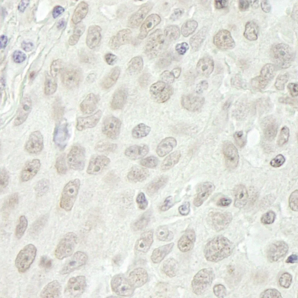 Rabbit anti-BubR1 IHC Antibody, Affinity Purified