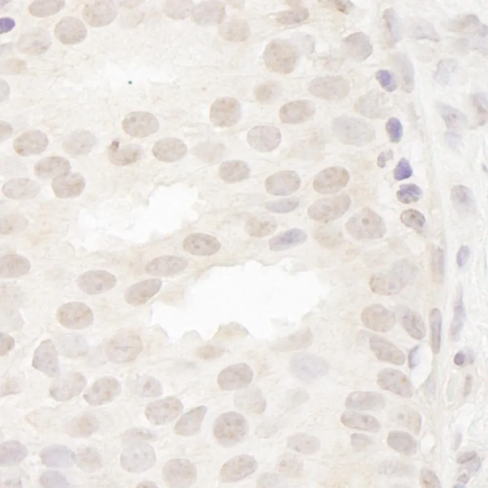 Rabbit anti-CASC5 IHC Antibody, Affinity Purified