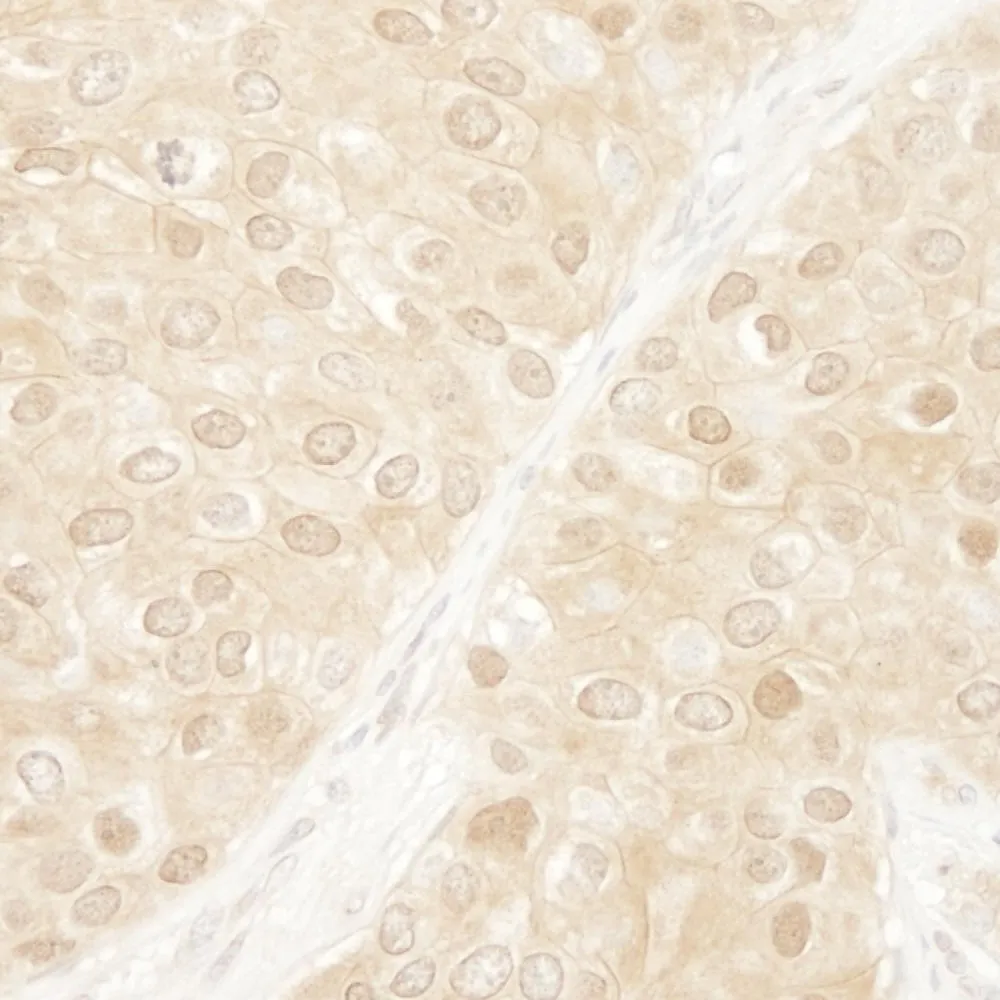 Rabbit anti-ERK1 IHC Antibody, Affinity Purified