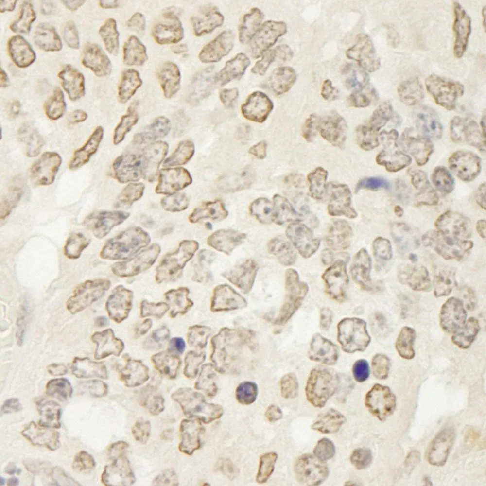 Rabbit anti-USP15 IHC Antibody, Affinity Purified