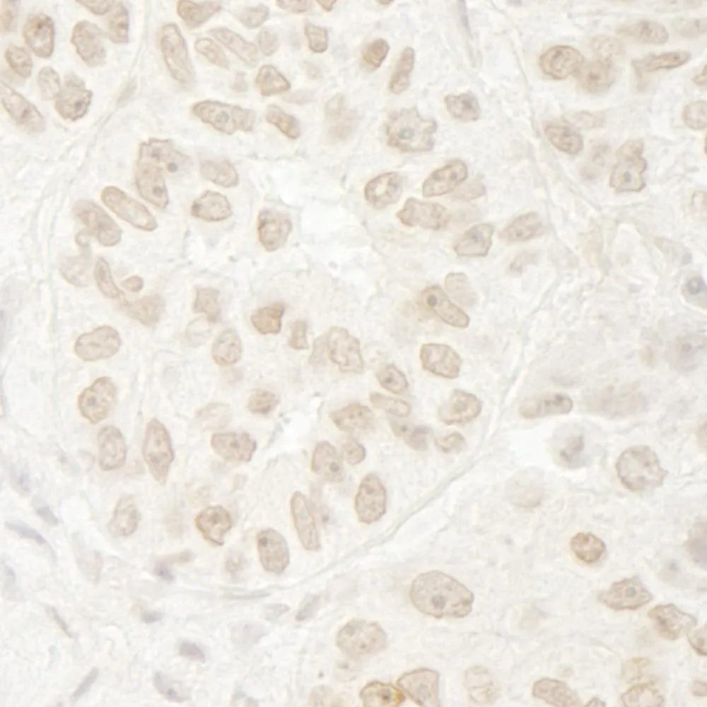 Rabbit anti-USP37 IHC Antibody, Affinity Purified