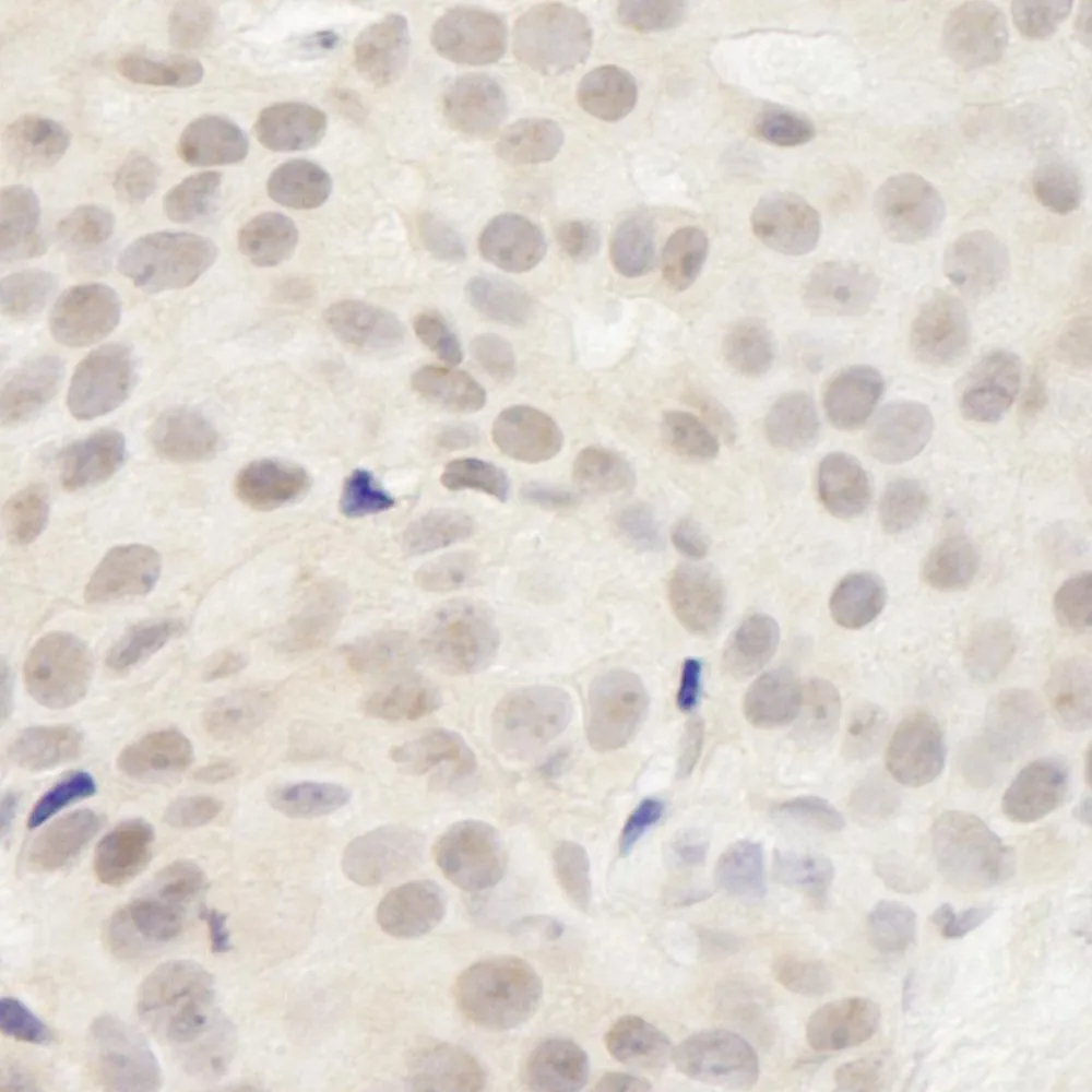 Rabbit anti-DDX23 IHC Antibody, Affinity Purified