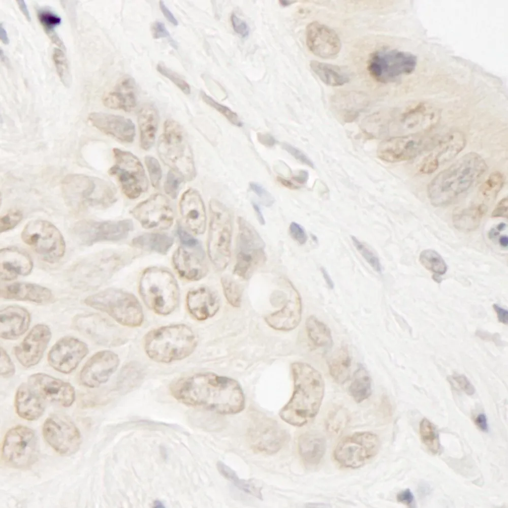 Rabbit anti-ARIP4 IHC Antibody, Affinity Purified