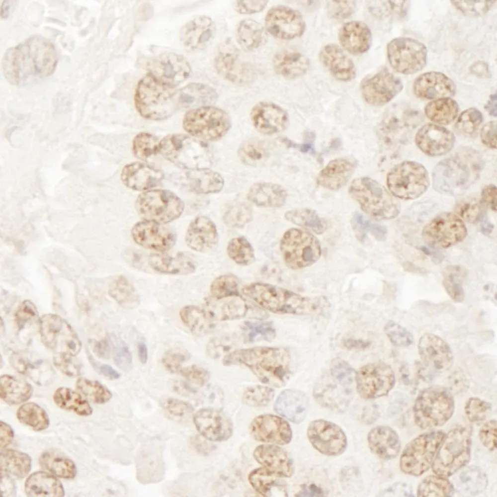 Rabbit anti-hPrp3p IHC Antibody, Affinity Purified