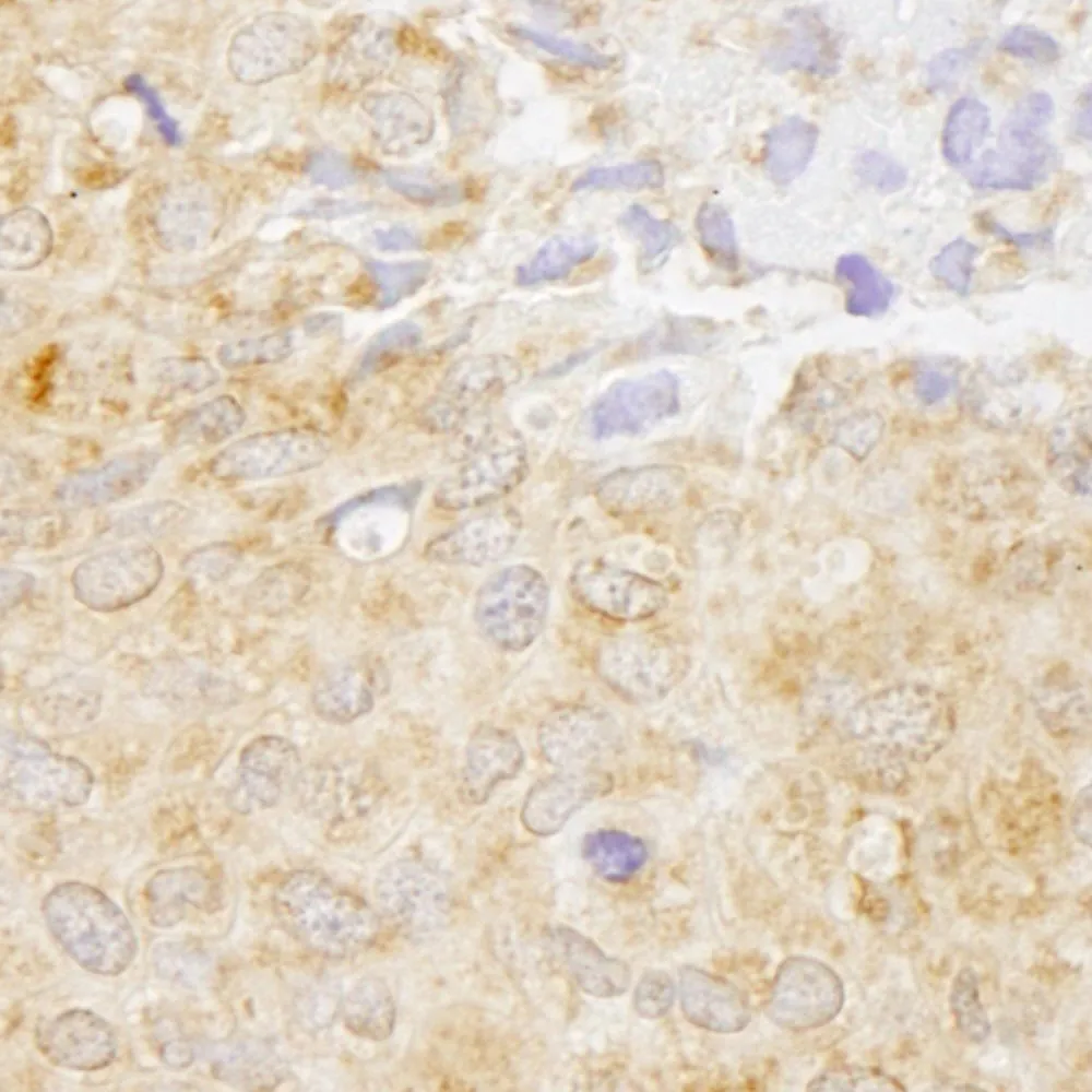 Rabbit anti-NF-kappaB1 IHC Antibody, Affinity Purified