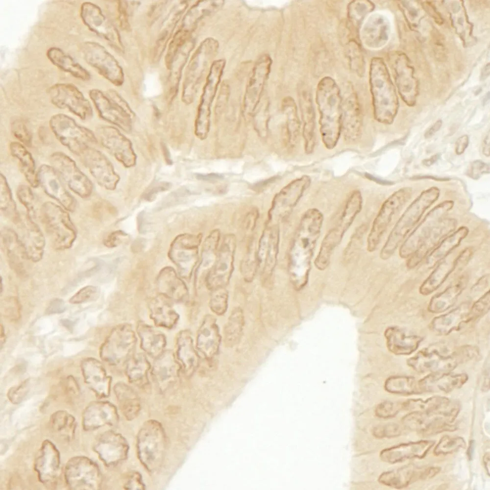 Rabbit anti-CTNND1 IHC Antibody, Affinity Purified