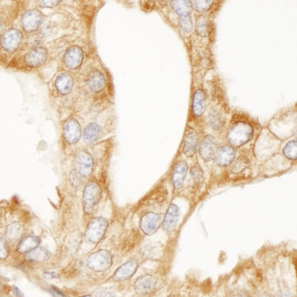Rabbit anti-MAP4 IHC Antibody, Affinity Purified