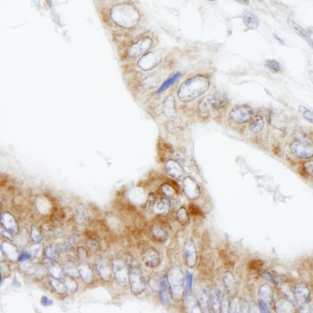 Rabbit anti-MAP7 IHC Antibody, Affinity Purified
