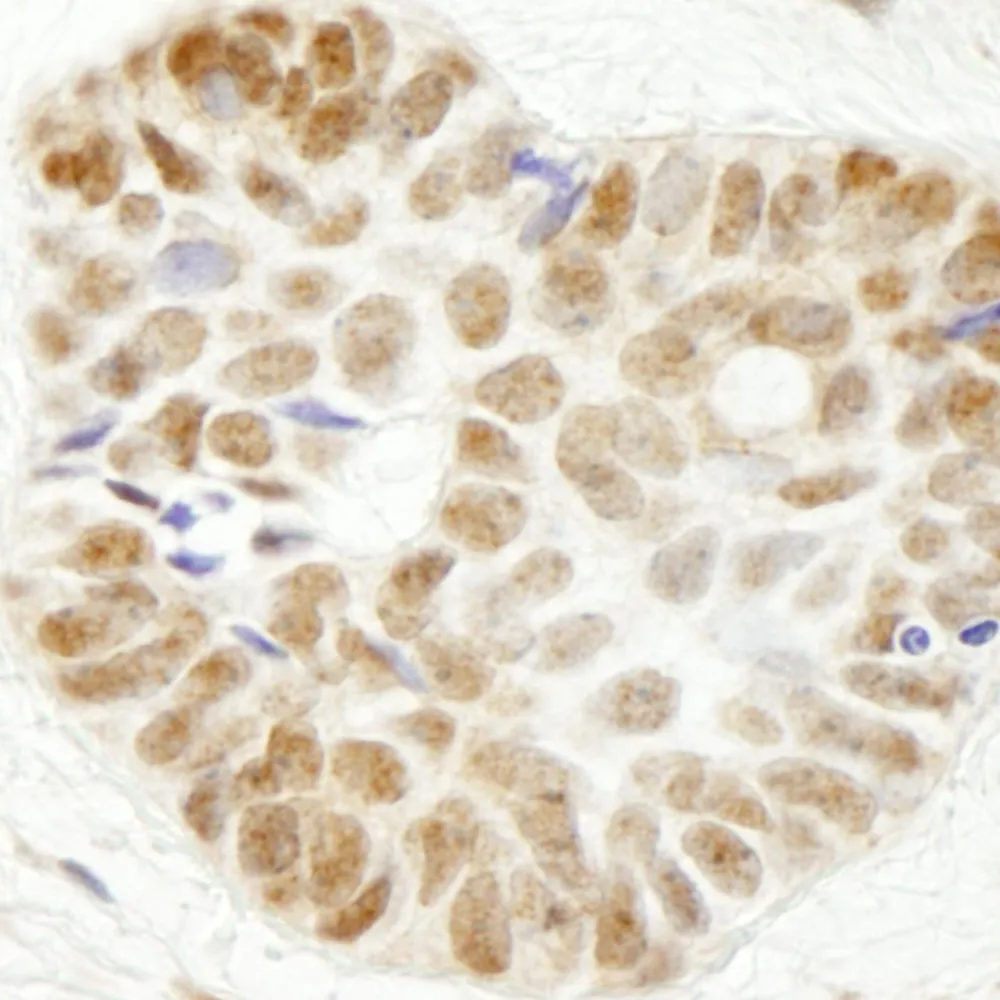 Rabbit anti-WDR79 IHC Antibody, Affinity Purified