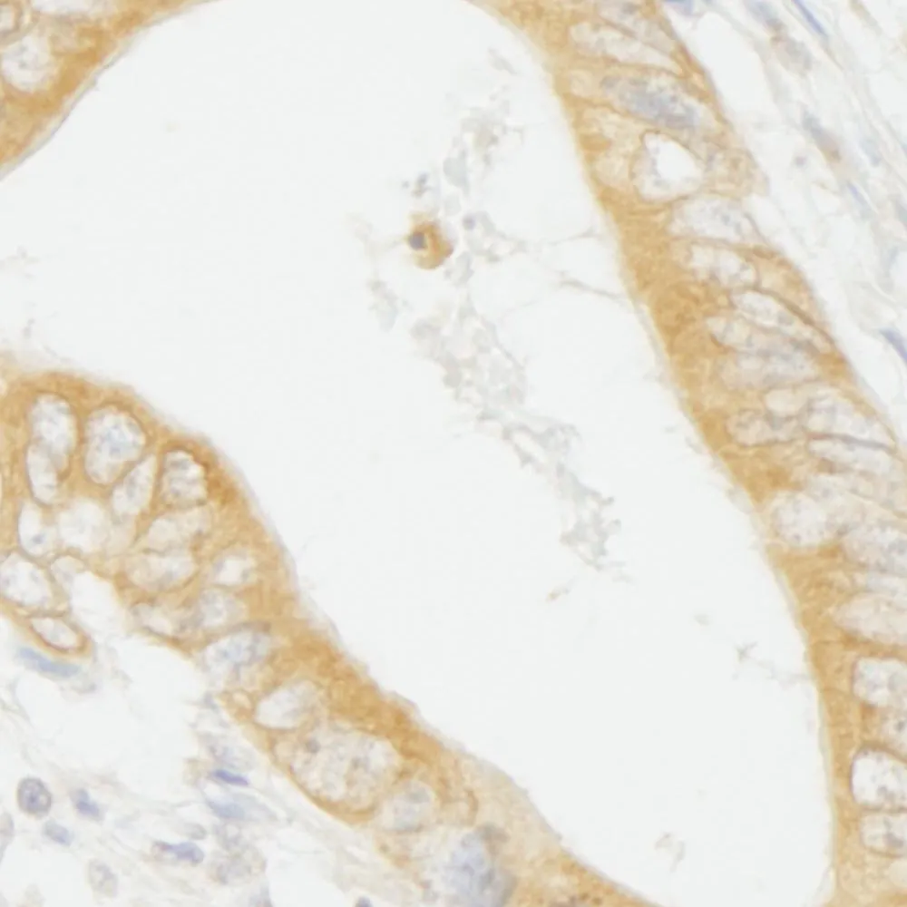 Rabbit anti-MAP4K4/HGK IHC Antibody, Affinity Purified