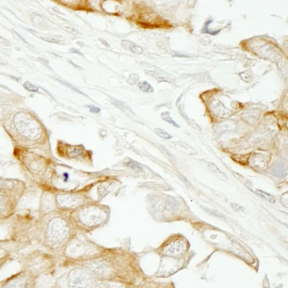 Rabbit anti-Notch2 IHC Antibody, Affinity Purified
