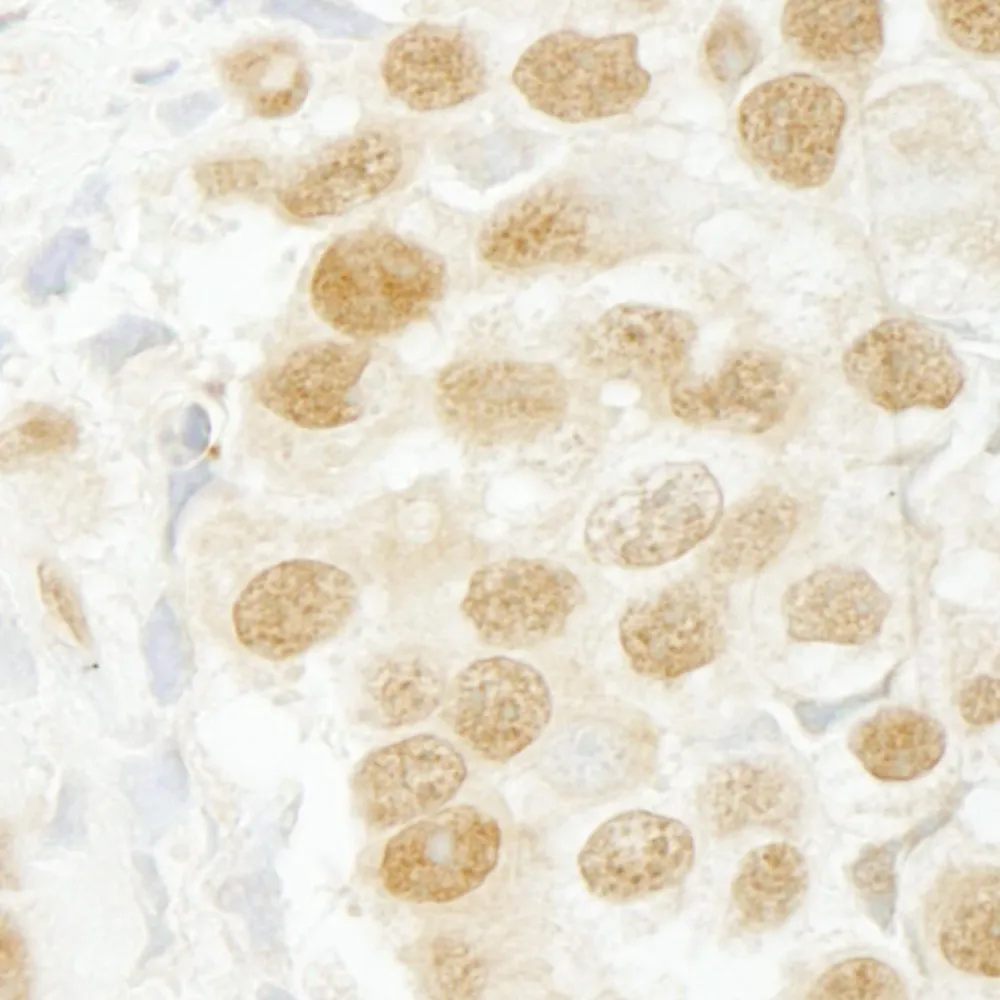 Rabbit anti-SFRS2IP IHC Antibody, Affinity Purified