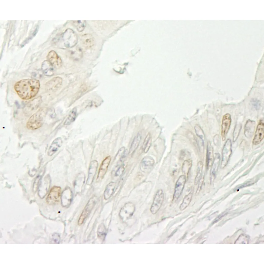 Rabbit anti-RBM10 IHC Antibody, Affinity Purified