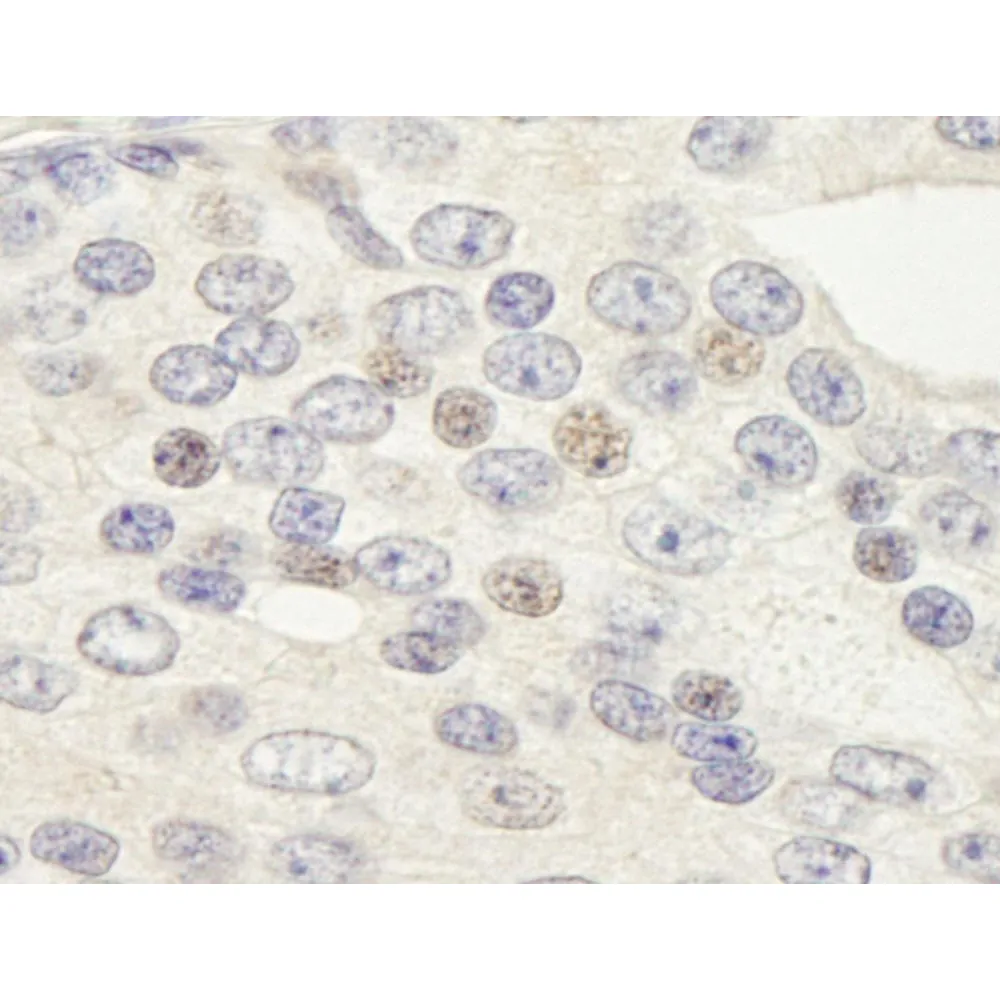 Rabbit anti-ZNF592 IHC Antibody, Affinity Purified