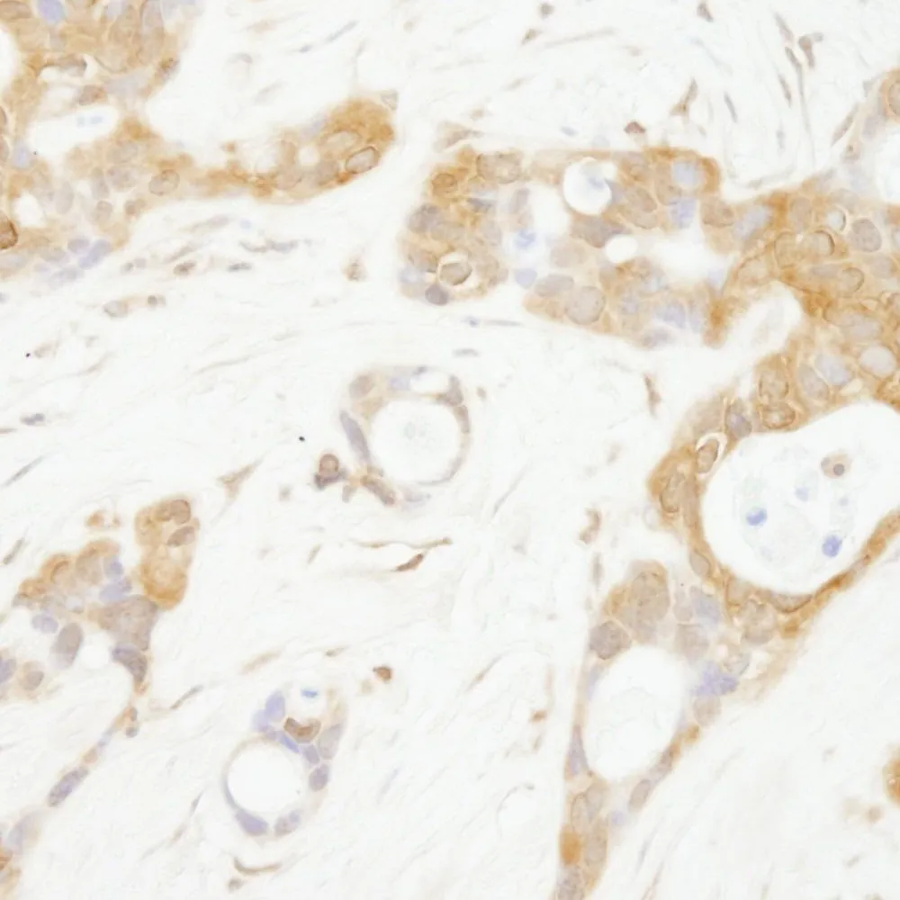 Rabbit anti-OSR1 IHC Antibody, Affinity Purified