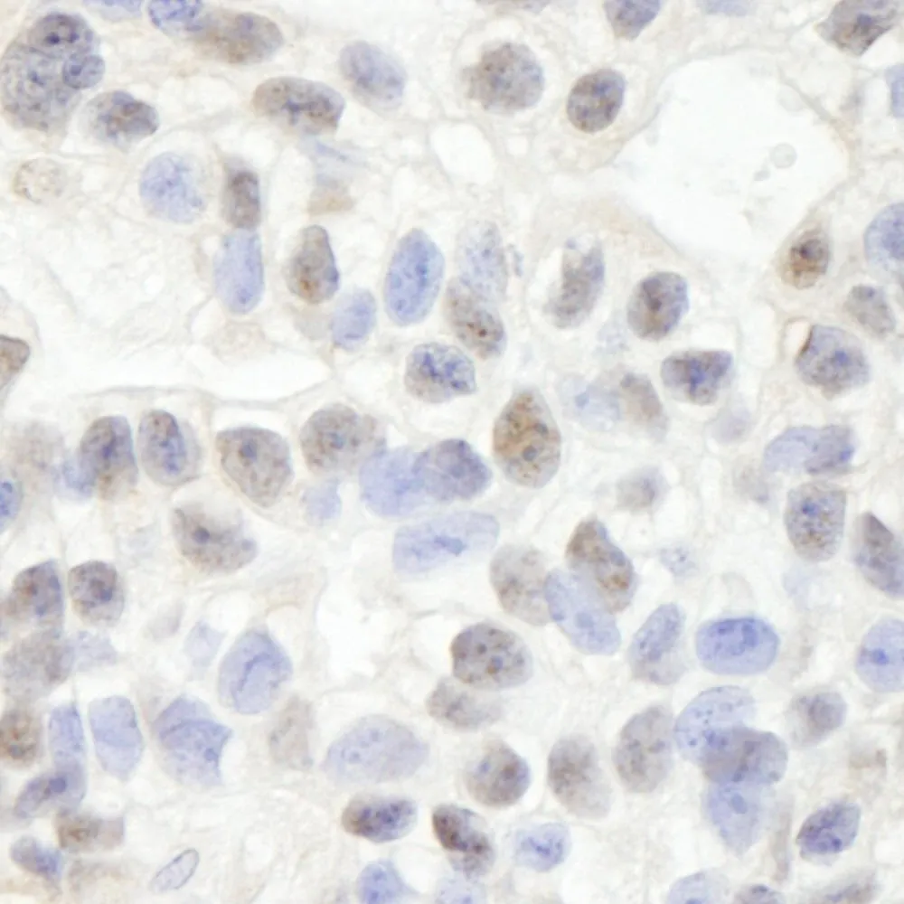Rabbit anti-NP95/UHRF1 IHC Antibody, Affinity Purified