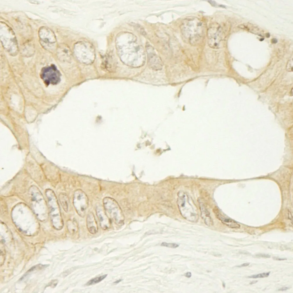 Rabbit anti-LARP1 IHC Antibody, Affinity Purified
