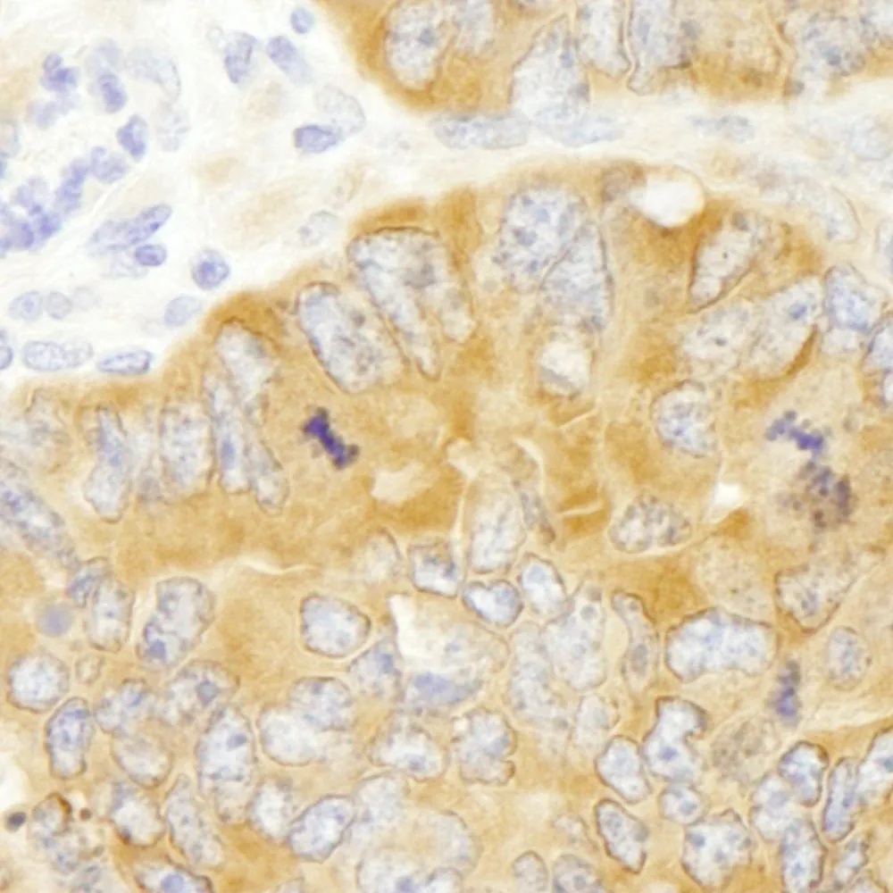 Rabbit anti-PABP4 IHC Antibody, Affinity Purified