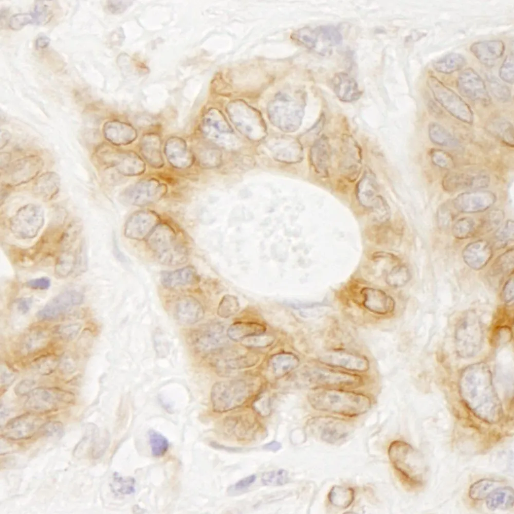 Rabbit anti-EML4 IHC Antibody, Affinity Purified