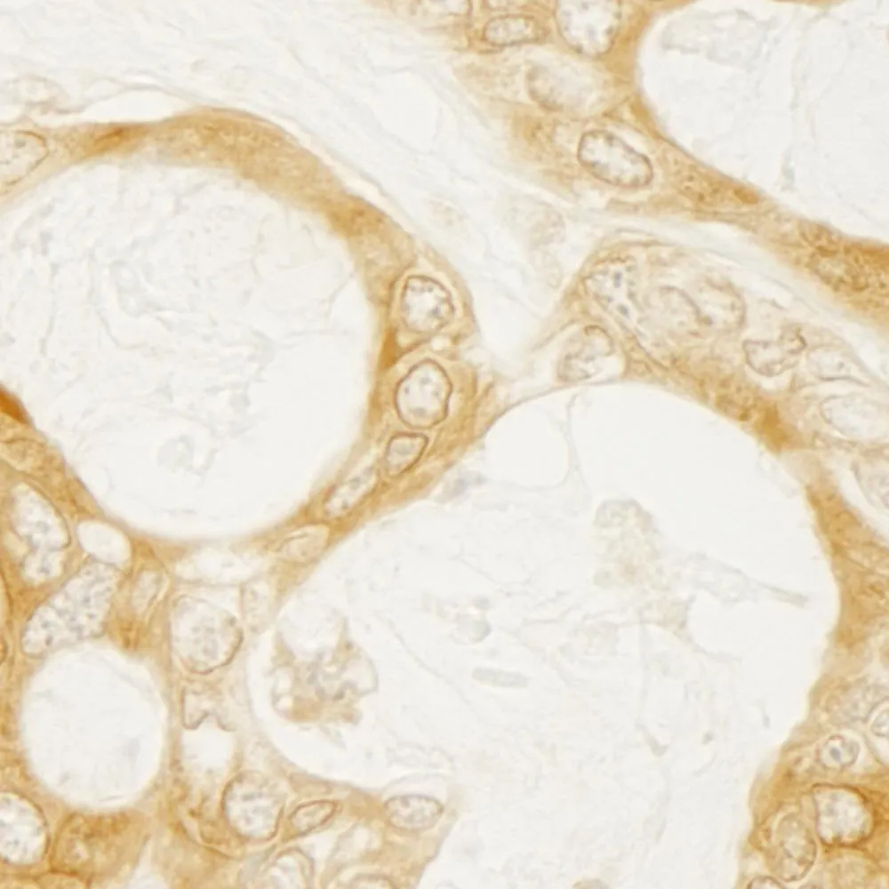 Rabbit anti-Diaphanous 1 IHC Antibody, Affinity Purified