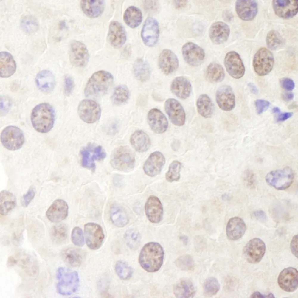 Rabbit anti-Menin IHC Antibody, Affinity Purified