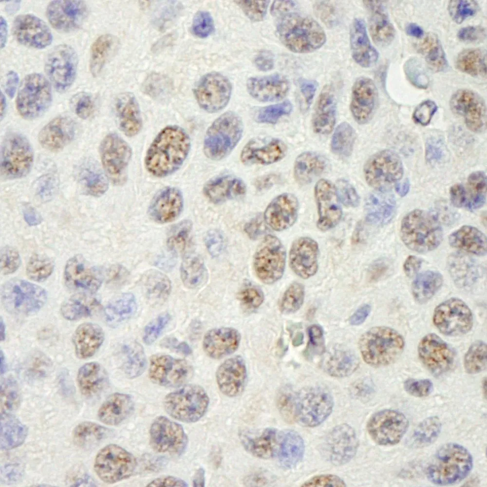 Rabbit anti-SAM68 IHC Antibody, Affinity Purified