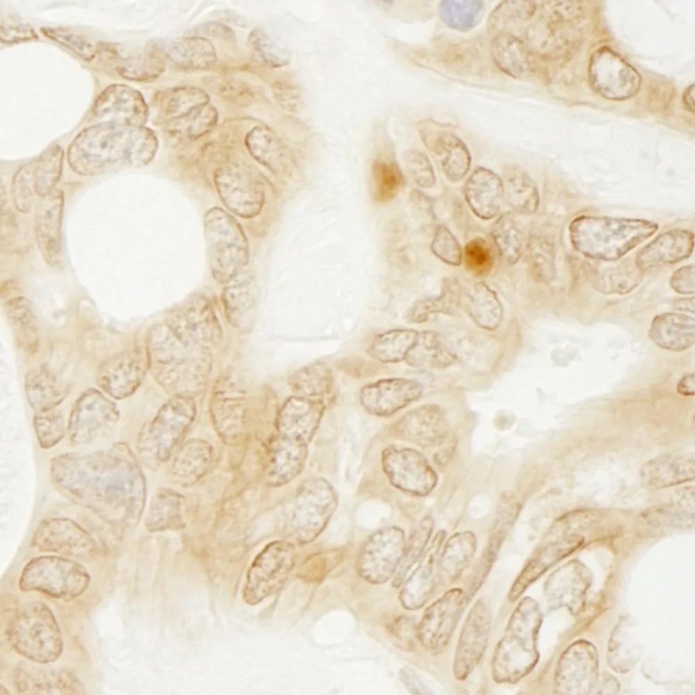 Rabbit anti-vPARP IHC Antibody, Affinity Purified