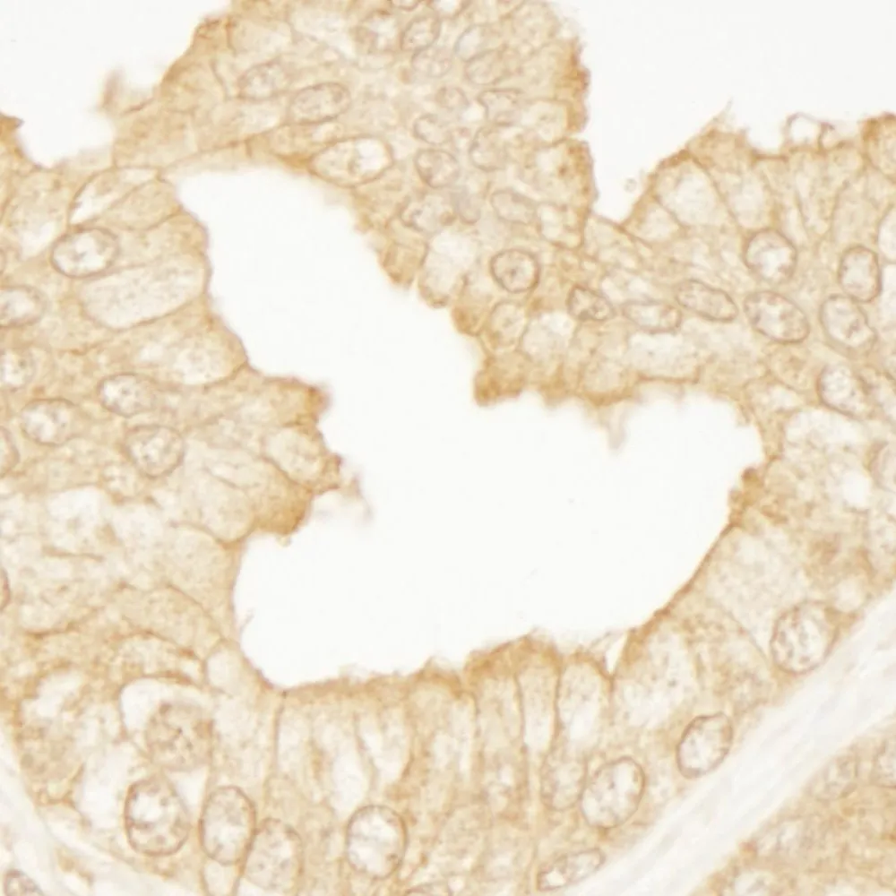 Rabbit anti-PDZ-RhoGEF IHC Antibody, Affinity Purified