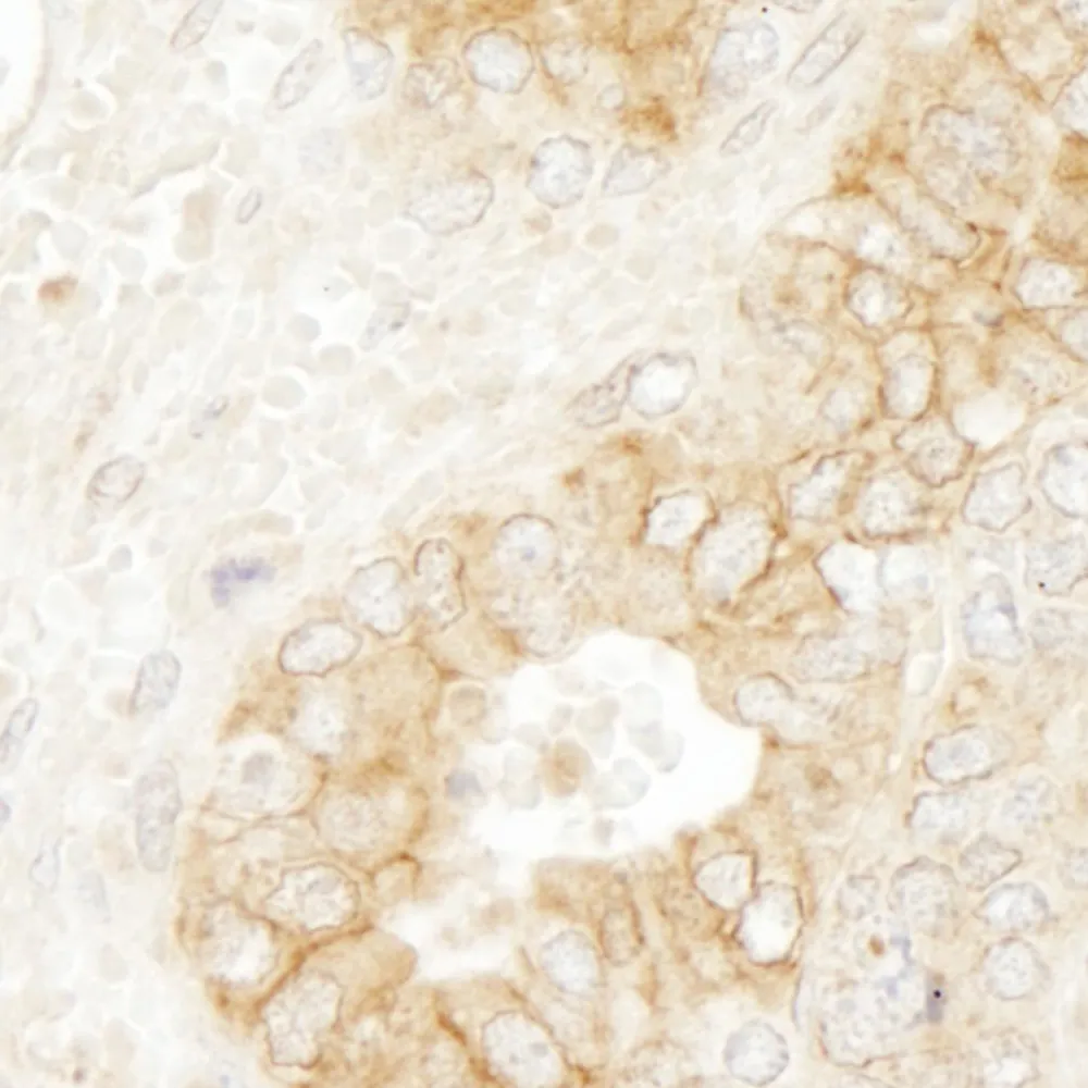 Rabbit anti-beta atenin IHC Antibody, Affinity Purified